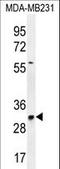 TNF Alpha Induced Protein 8 Like 3 antibody, LS-C162055, Lifespan Biosciences, Western Blot image 