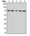 Ecto-NOX disulfide-thiol exchanger 2 antibody, LS-B14522, Lifespan Biosciences, Western Blot image 