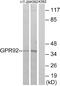 Lysophosphatidic Acid Receptor 5 antibody, A30831, Boster Biological Technology, Western Blot image 