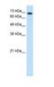 Ribophorin II antibody, NBP1-62480, Novus Biologicals, Western Blot image 