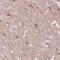 Secretogranin-3 antibody, PA5-52357, Invitrogen Antibodies, Immunohistochemistry paraffin image 