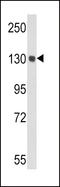 Ceruloplasmin antibody, LS-C166975, Lifespan Biosciences, Western Blot image 