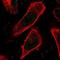 COP9 Signalosome Subunit 4 antibody, NBP1-85434, Novus Biologicals, Immunocytochemistry image 