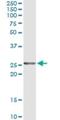 Twist-related protein 2 antibody, H00117581-M12, Novus Biologicals, Immunoprecipitation image 