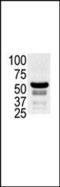 P21 (RAC1) Activated Kinase 2 antibody, PA5-15116, Invitrogen Antibodies, Western Blot image 