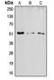 Activating Transcription Factor 2 antibody, LS-C352058, Lifespan Biosciences, Western Blot image 