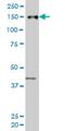 Zinc Finger MYND-Type Containing 8 antibody, H00023613-M06, Novus Biologicals, Western Blot image 