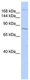 Ubiquitin Protein Ligase E3 Component N-Recognin 1 antibody, TA331587, Origene, Western Blot image 