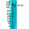 Solute Carrier Family 12 Member 5 antibody, MA5-27610, Invitrogen Antibodies, Western Blot image 