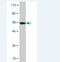 Collagen Type II Alpha 1 Chain antibody, H00001280-M06, Novus Biologicals, Western Blot image 