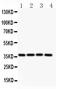 MCL1 Apoptosis Regulator, BCL2 Family Member antibody, PB9132, Boster Biological Technology, Western Blot image 