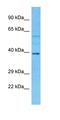 Dynein Axonemal Assembly Factor 3 antibody, orb326910, Biorbyt, Western Blot image 