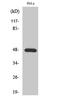 Inward rectifier potassium channel 2 antibody, STJ93838, St John