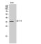 Adrenoceptor Beta 3 antibody, STJ91728, St John