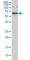 Papillary thyroid carcinoma-encoded protein antibody, H00008030-M03, Novus Biologicals, Western Blot image 