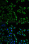 Mesothelin antibody, 15-369, ProSci, Immunofluorescence image 