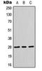 Hes Family BHLH Transcription Factor 6 antibody, LS-C354187, Lifespan Biosciences, Western Blot image 