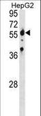 Serine Palmitoyltransferase Long Chain Base Subunit 2 antibody, LS-C156125, Lifespan Biosciences, Western Blot image 