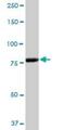 Adenosine Deaminase RNA Specific B1 antibody, H00000104-B02P, Novus Biologicals, Western Blot image 