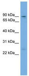 Zinc finger Y-chromosomal protein 1 antibody, TA341829, Origene, Western Blot image 