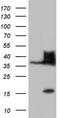 NK3 Homeobox 1 antibody, LS-C339510, Lifespan Biosciences, Western Blot image 