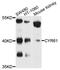 CYR61 antibody, LS-C335126, Lifespan Biosciences, Western Blot image 