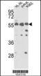 Protein Interacting With PRKCA 1 antibody, 62-642, ProSci, Western Blot image 