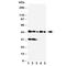 Haptoglobin antibody, R30677, NSJ Bioreagents, Western Blot image 