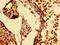 HIF-2-alpha antibody, LS-C675045, Lifespan Biosciences, Immunohistochemistry paraffin image 