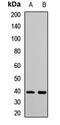 Interferon Regulatory Factor 2 antibody, LS-C667867, Lifespan Biosciences, Western Blot image 