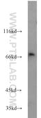 Synaptotagmin Like 3 antibody, 22076-1-AP, Proteintech Group, Western Blot image 