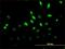 Mitogen-Activated Protein Kinase 6 antibody, H00005597-M02, Novus Biologicals, Immunocytochemistry image 