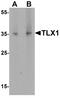T Cell Leukemia Homeobox 1 antibody, A04342, Boster Biological Technology, Western Blot image 
