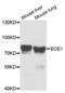 Endothelin Converting Enzyme 1 antibody, PA5-76767, Invitrogen Antibodies, Western Blot image 