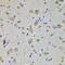 Eukaryotic Translation Initiation Factor 4A2 antibody, 19-185, ProSci, Immunohistochemistry frozen image 