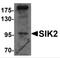 Salt Inducible Kinase 2 antibody, 6301, ProSci, Western Blot image 