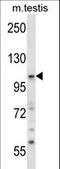 Sorting Nexin 14 antibody, LS-C161364, Lifespan Biosciences, Western Blot image 