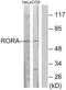 RAR Related Orphan Receptor A antibody, LS-B7055, Lifespan Biosciences, Western Blot image 