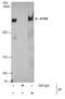 ATRX Chromatin Remodeler antibody, PA5-21348, Invitrogen Antibodies, Immunoprecipitation image 