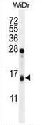 Translocase Of Outer Mitochondrial Membrane 20 Like antibody, AP54329PU-N, Origene, Western Blot image 