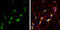 Calcitonin gene-related peptide 1 antibody, GTX134005, GeneTex, Immunofluorescence image 