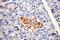 Fukutin antibody, 18276-1-AP, Proteintech Group, Immunohistochemistry paraffin image 