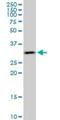 RNA polymerase transcriptional regulation mediator subunit 7 homolog antibody, H00009443-M02, Novus Biologicals, Western Blot image 