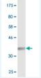 Synaptogyrin 2 antibody, H00009144-M03, Novus Biologicals, Western Blot image 