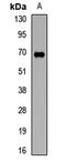 TRNA Methyltransferase 2 Homolog A antibody, LS-C668876, Lifespan Biosciences, Western Blot image 