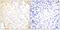 NK3 Homeobox 1 antibody, A30460, Boster Biological Technology, Immunohistochemistry paraffin image 