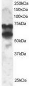 Protein Phosphatase 2 Regulatory Subunit B'Delta antibody, TA302740, Origene, Western Blot image 