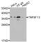 TNF Superfamily Member 13 antibody, STJ25902, St John