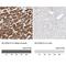 Solute Carrier Family 25 Member 12 antibody, NBP2-38249, Novus Biologicals, Immunohistochemistry paraffin image 