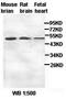 Alpha Kinase 3 antibody, orb77559, Biorbyt, Western Blot image 